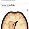 CONTINUUM Lifelong Learning in Neurology (Neuro-oncology) December 2023, Vol.29, No.6 (TRUE PDF)
