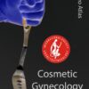 ISCG Video Atlas of Cosmetic Gynecology