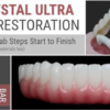 AOX Crystal Ultra Hybrid Restoration: All Clinical & Lab Steps Start to Finish
