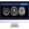 Case Review of Neuroradiology