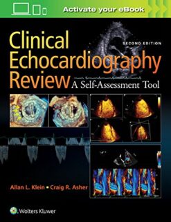 Clinical Echocardiography Review A Self-Assessment Tool, Second Edition pdf