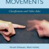 Involuntary Movements: Classification