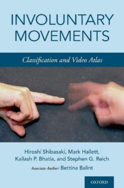 Involuntary Movements: Classification