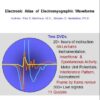 EMG/NCS Online Series: Volume II: Electronic Atlas of Electromyographic Waveforms