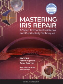 Mastering Iris Repair: A Video Textbook of Iris Repair and Pupilloplasty Techniques (PDF Book)