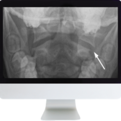 Neuroradiology Review for the Practicing Radiologist 2018