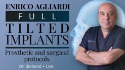 Full tilted implants Prosthetic and Surgical protocols 2023