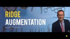 Ridge Augmentation – Luca De Stavola