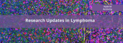 Cedars Sinai Research Updates in Lymphoma 2024