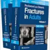 Rockwood and Green’s Fractures in Adults, 10th Edition (Videos)
