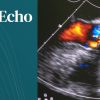 Harvard Boston 3D Echo Workshop 2025