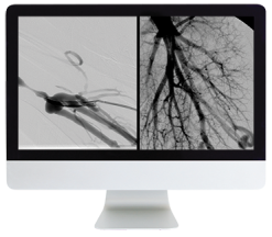 ARRS Case Review of Vascular and Interventional Radiology 2023 (Videos)