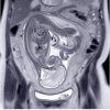 UCSF ObGyn Women’s Imaging 2025 (Videos + Slides PDFs)