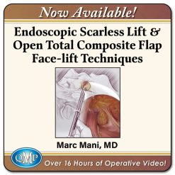 Scarless Endoscopic & Open Composite Plane Face-lifting Techniques 2025