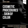 Procedures In Cosmetic Dermatology: Cosmetic Procedures In Skin Of Color