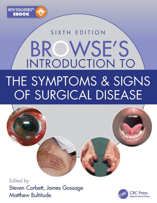Browse’s Introduction to the Symptoms & Signs of Surgical Disease 6th Edition