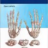 Synopsis Of Hand Surgery (EPUB)