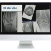 ARRS 3D MR Imaging of Joints with Arthroscopy Correlations 2023