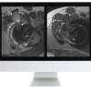 ARRS Controversies In Hip And Pelvis Imaging 2016 (CME VIDEOS)