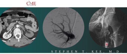 Science Interventional Radiology Stephen T. Kee, M.D 2021