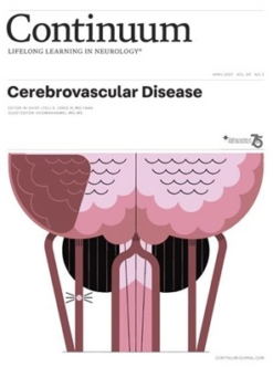 CONTINUUM Lifelong Learning in Neurology April 2023, Volume 29, Issue 2 (True PDF)