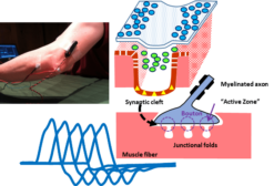 EMG/NCS Online Series: Volume XII Repetitive Nerve Stimulation