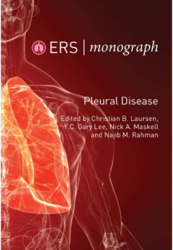 ERS Monograph 87 Pleural Disease (ORIGINAL PDF from Publisher)
