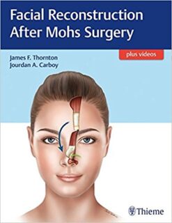 Facial Reconstruction After Mohs Surgery (EPUB)