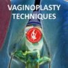 ISCG Vaginoplasty Techniques for Surgeons