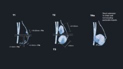 MRIOnline Mastery Series: Evaluation of Newly Diagnosed, Pre-Operative Breast Cancer Patients 2021 (CME VIDEOS)