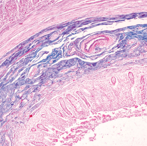 Masters of Pathology -Gastropathology 2024