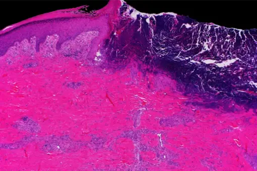 Mayo Clinic Wound Symposium: The Edges Of Wound Care 2023 (Videos+Assessment Quiz)