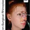 Non-Surgical Rhinoplasty (The PRIME Series) (pdf)