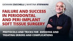 Osteocom - Failure and Success in Periodontal and Peri-Implant Soft Tissue Surgery - Giovanni Zucchelli and Martina Stefanini