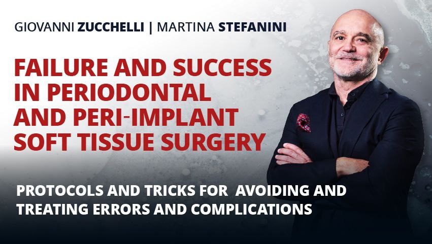 Osteocom - Failure and Success in Periodontal and Peri-Implant Soft Tissue Surgery - Giovanni Zucchelli and Martina Stefanini