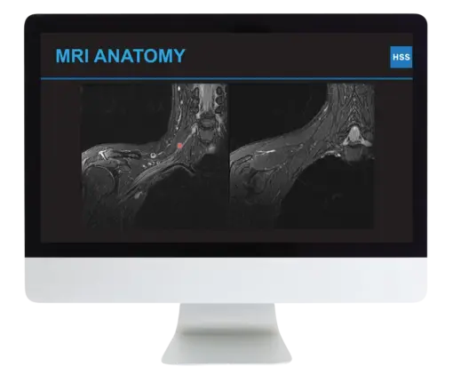 Plexus and Peripheral Nerve Imaging 2024