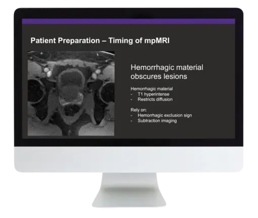 Prostate MR Case Review 2024