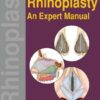 Rhinoplasty: An Expert Manual (Original PDF From Publisher)