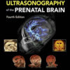 Timor’s Ultrasonography of the Prenatal Brain, 4th edition (Original PDF from Publisher)
