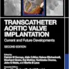 Transcatheter Aortic Valve Implantation: Current and Future Developments, 2nd edition (Original PDF from Publisher)