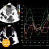 Oakstone Echocardiography A Comprehensive Review 2022