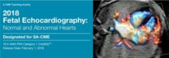 2018 Fetal Echocardiography: Normal and Abnormal Hearts