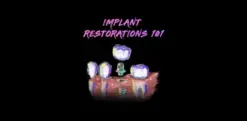 Implant Restorations 101 – Implant Ninja
