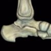 MRI Online MRI Mastery Series: Ankle 2017