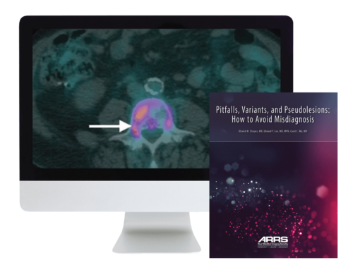 ARRS Pitfalls, Variants, and Pseudolesions: How to Avoid Misdiagnosis 2019