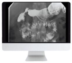 ARRS Practical Pediatric Imaging 2021