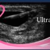 Pegasus Breast Ultrasound video course 2022