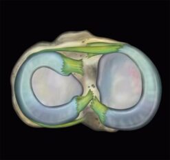 MRI Online MRI Mastery Series Elbow 2021