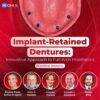 OHI-S Implant-Retained Dentures: Innovative Approach to Full-Arch Prosthetics