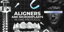 OHI-S Aligners And Microimplants In One Protocol